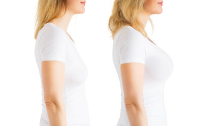 Mastopexy Augmentation (Breast Uplift): The Complete Guide to Breast Lift with Implants